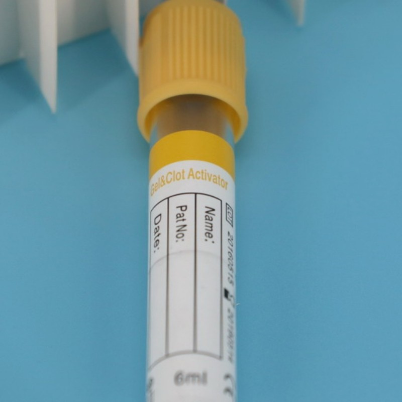 specimen tube (2)