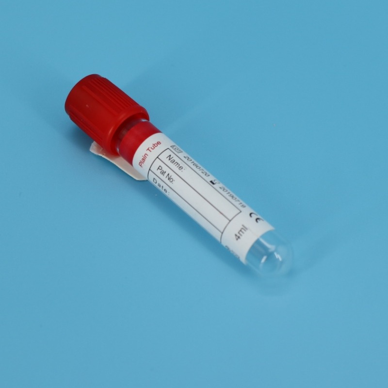 specimen tube (1)