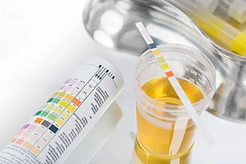 Collection of common urine specimens